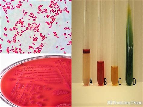 Biochemical Tests For Escherichia coli (E. coli) | Bacteriology Notes