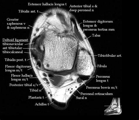 MRI Anatomy: Explore Medical Ultrasound and Radiology