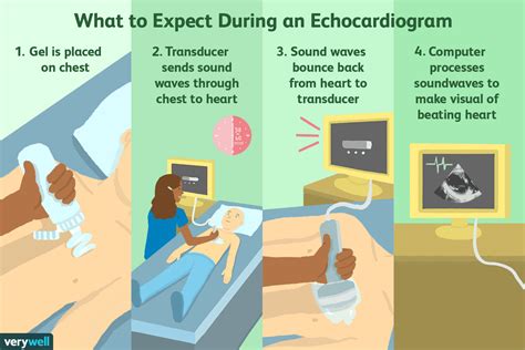 How Long Is Echocardiogram Valid? - PostureInfoHub