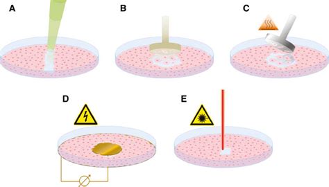 In vitro wound healing assays – state of the art