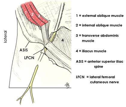 Nerve Pain: Dorsal Cutaneous Nerve Pain