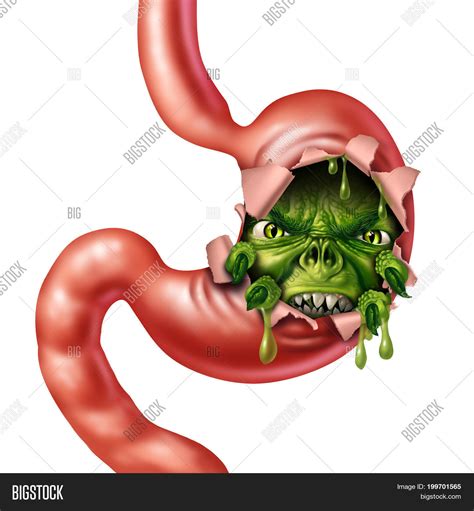 Upset Stomach Nausea Image & Photo (Free Trial) | Bigstock