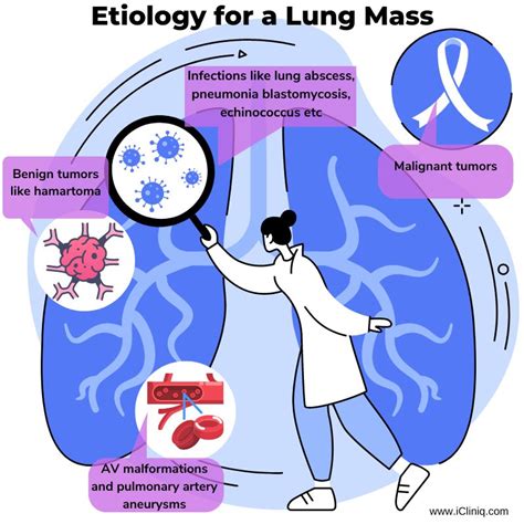 Lung Mass | Symptoms | Diagnosis | Treatment