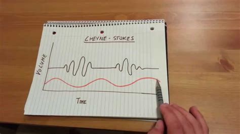 Cheyne-Stokes Respiration - YouTube