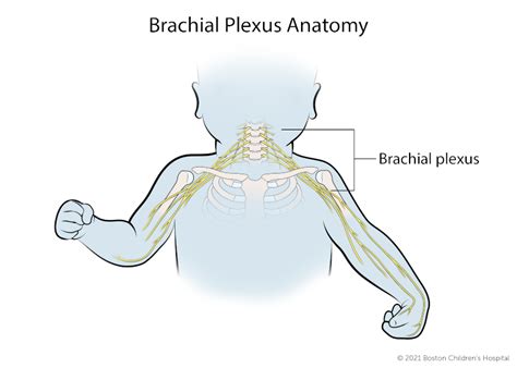 Brachial Plexus Birth Injury | Boston Children's Hospital