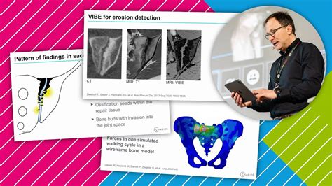 Advanced imaging of spondyloarthropathies*: What is new? // *aka ...