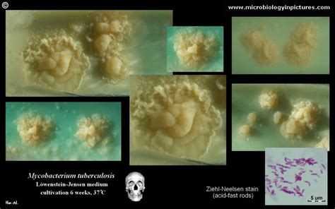 Bacteria Mycobacterium tuberculosis | Mefics