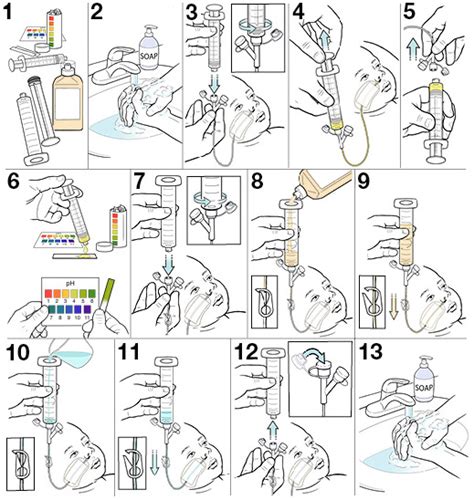 Step-by-Step: Feeding an Infant with an NG Tube | Saint Luke's Health ...