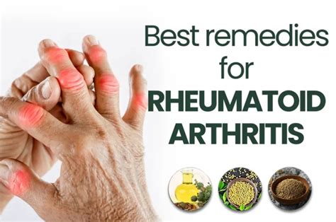 Arthritis Treatment: Discover the Best Home Remedies