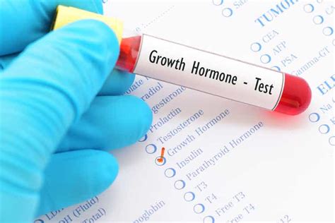 Novo growth hormone therapy gets EMA nod for use in kids | Seeking Alpha