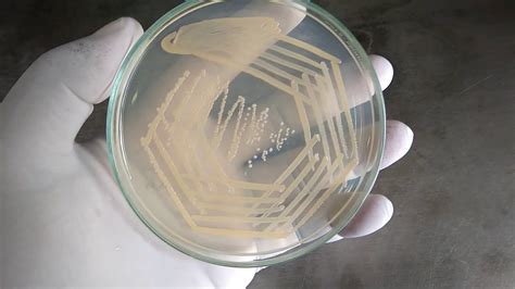 poumon Aligner choquant staphylococcus aureus culture plate marieur ...