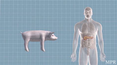 Researchers Grow First Human-Pig Chimeras - MPR