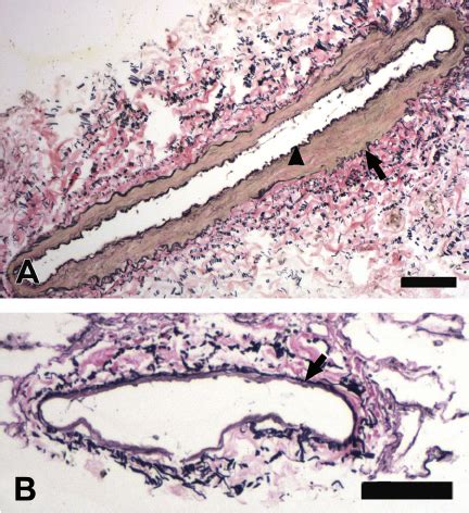 Pulmonary Artery Histology