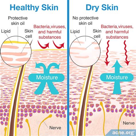 Dry Skin: Causes and Treatments - Acne.org