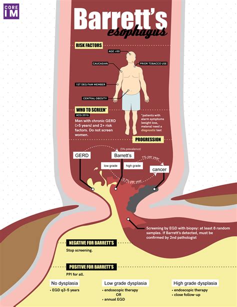 Does Barretts Esophagus Lead To Cancer - CancerWalls