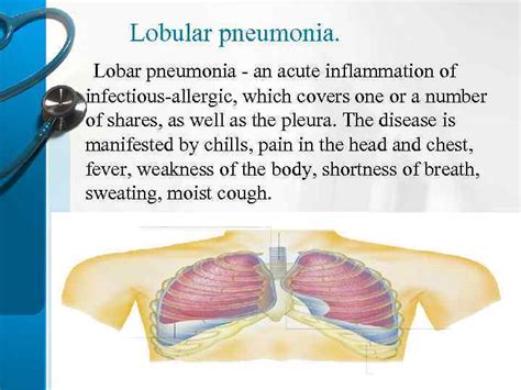 Lobular pneumonia Plan Lobular