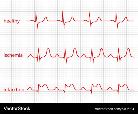 Heart cardiogram charts set healthy Royalty Free Vector