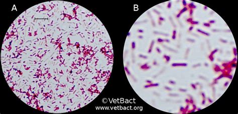 Pseudomonas Aeruginosa Gram Stain