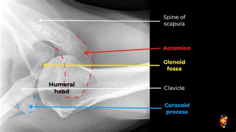 Shoulder Anatomy X Ray Labeled