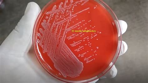 E. coli: Introduction, Identification Features, Keynotes