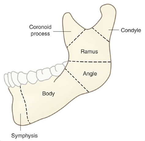 Mandible Fractures | Plastic Surgery Key