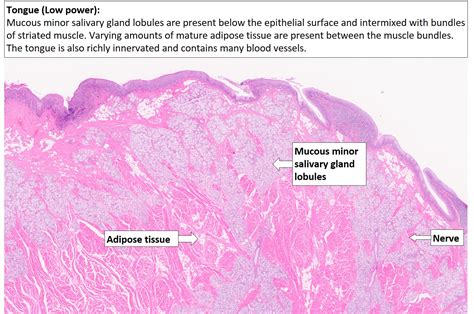 Tongue – Normal Histology – NUS Pathweb :: NUS Pathweb