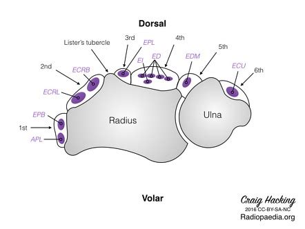 Image | Radiopaedia.org