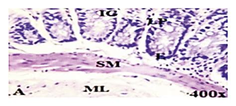 Photomicrographs of the naïve control (a) and croton oil-induced ...