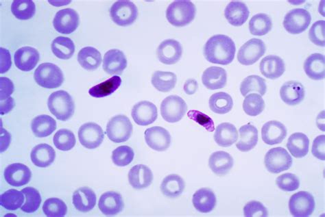 Plasmodium falciparum - Wikipedia