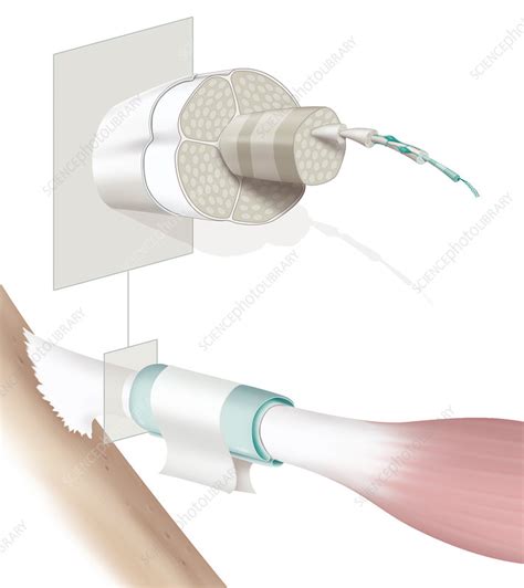 Tendon, illustration - Stock Image - C035/4651 - Science Photo Library