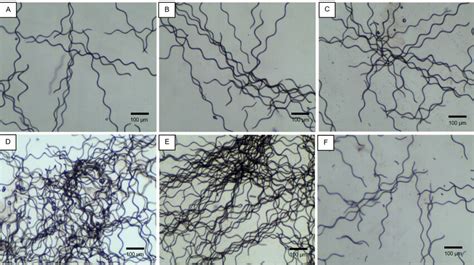 Microscopic examination of flocculated spirulina (Arthrospira ...