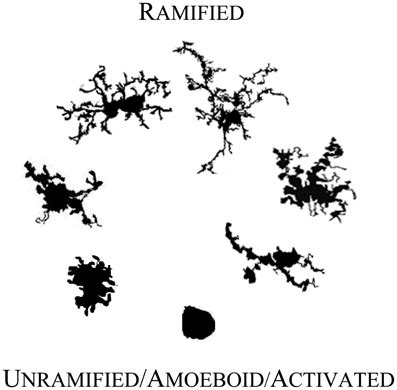 Are Microglia the Most Intelligent Brain Cells