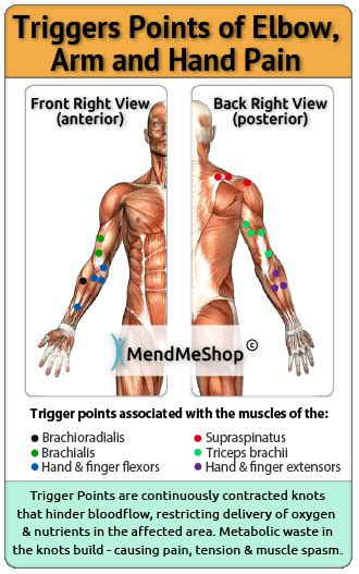 Forearm Muscle Strain