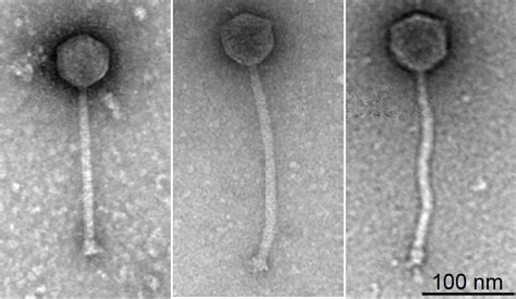 Electron Microscope Bacteriophage