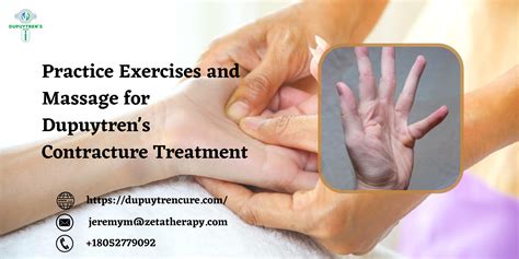 Practice Exercises and Massage for Dupuytren's Contracture Treatment by ...