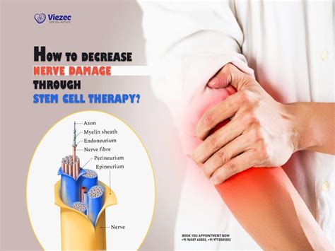 HOW TO DECREASE NERVE DAMAGE THROUGH STEM CELL THERAPY