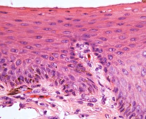 Stratified Squamous Epithelium Non Keratinized Labeled