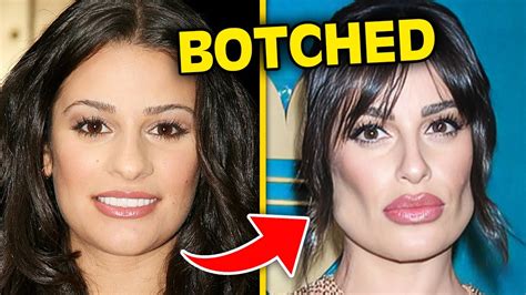 Top 10 Celebrities Who Destroyed Their Looks With BOTCHED Plastic ...