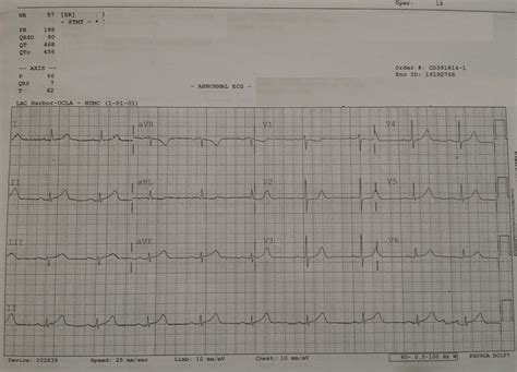 emDOCs.net – Emergency Medicine EducationPosterior MI Recognition ...