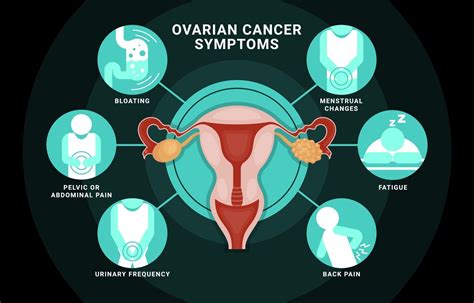 Ovarian Cancer SVG