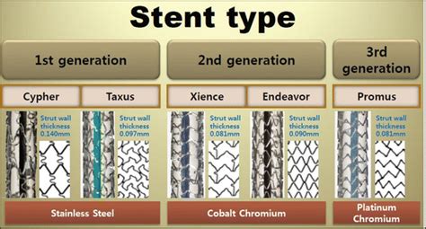 Different Types Of Stents