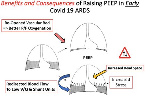 JCM | Free Full-Text | The Respiratory Mechanics of COVID-19 Acute ...