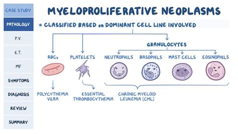 Myeloproliferative disorders: Pathology review: Video | Osmosis