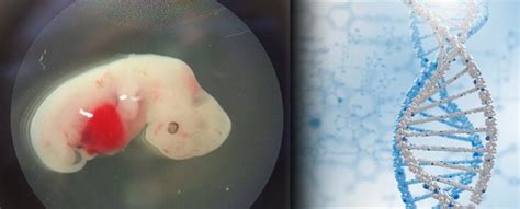 Scientists Create Human-Pig Embryo for Transplant Research