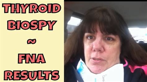 Thyroid Biopsy ~ FNA ~ Fine Needle Aspiration ~ Results - YouTube