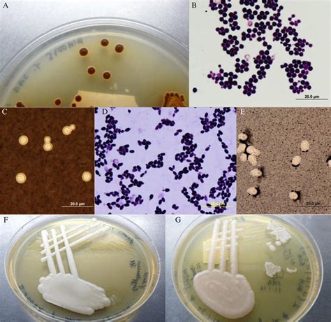 Cryptococcus neoformans var. grubii: (A) brown colony effect (BCE) on ...