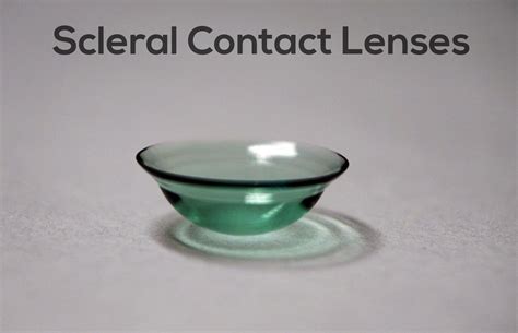 Contact Lenses for Keratoconus: What Are Your Options? | Soft contact ...