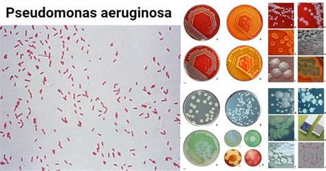 Şase etern Ce drăguț microscopie gram pseudomonas aeruginosa Reporter ...