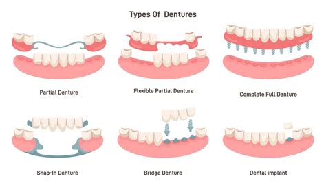 5 Main Causes for Denture Pain & How To Treat It