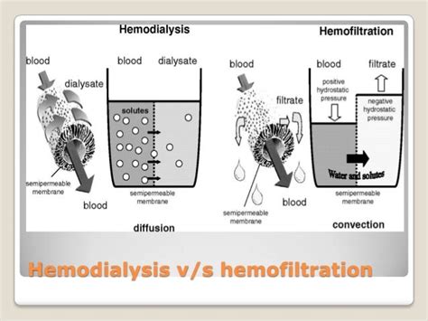 Dialysis